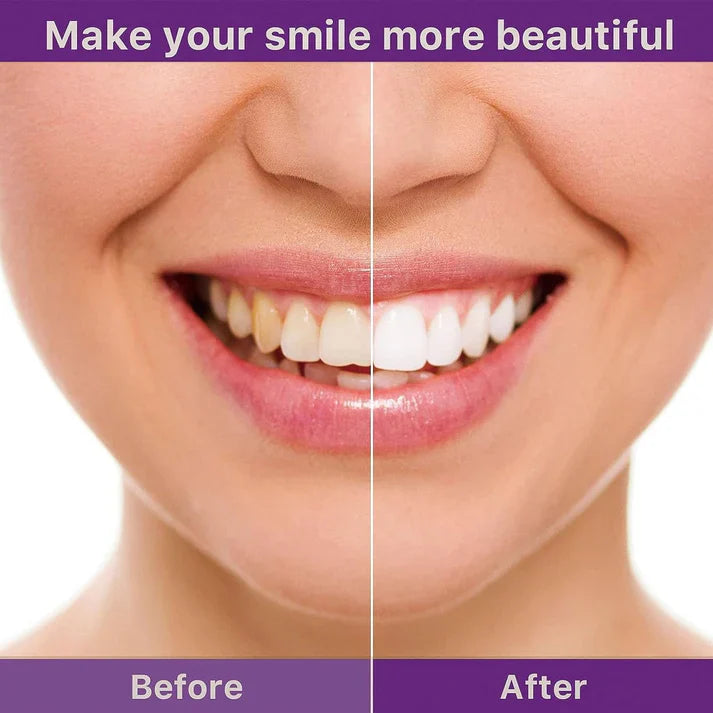 Korean Hi-Smile Teeth Shiner & Cleaner